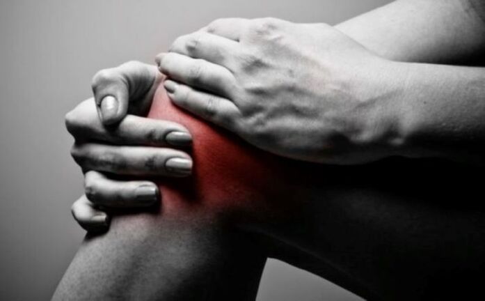 Knee arthritis