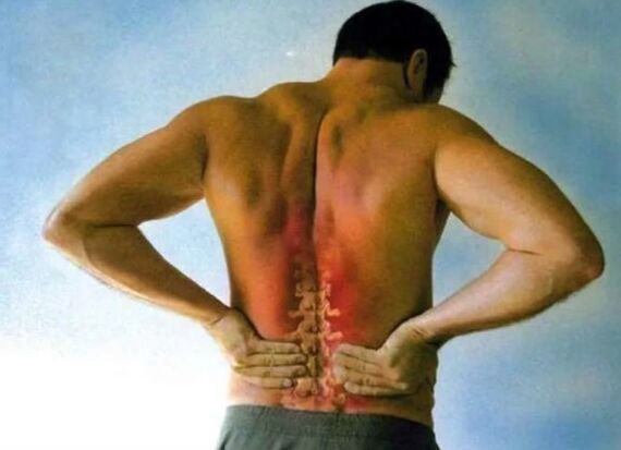 Lumbar osteochondrosis